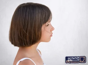 افتادگی لب بالا بعد از عمل بینی - دکتر امیرحسین سروری