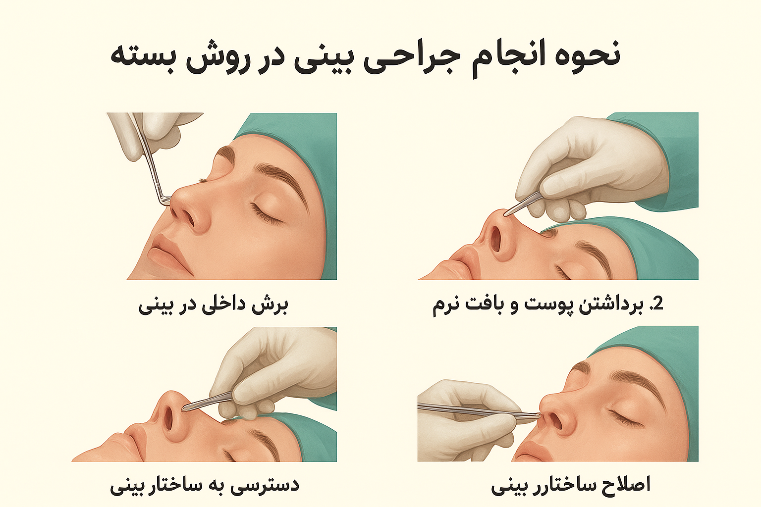 جراحی بینی به روش بسته مجله زیبایی دکتر امیرجسین سروری